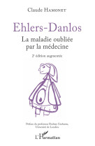 Ehlers-danlos